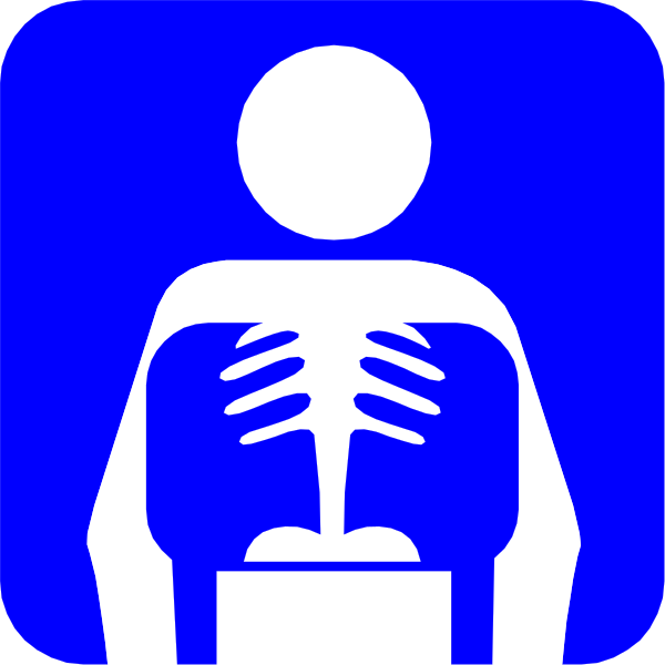 The image shows a blue icon with white text that reads "X-ray" inside it on top of an illustration depicting a human figure from behind standing in front of what appears to be a medical device, possibly for taking X-rays.
