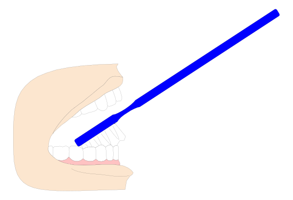 The image shows a cartoon of an open mouth with teeth on either side holding up two blue lines that appear to be laser pointers pointing at each other from opposite ends within what looks like a dark space.