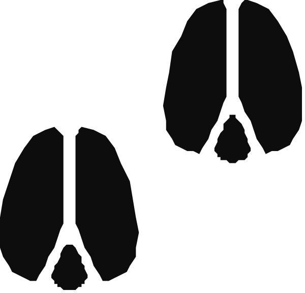 The image shows four silhouettes of leaves against a black background with no additional context provided about their location or any other elements present in the scene.