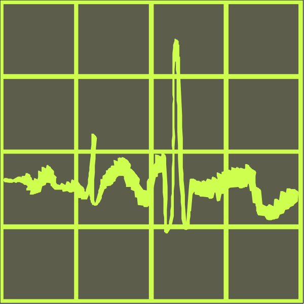 The image shows a black background with yellow lines forming an ECG pattern on it within what appears to be a grid-like structure that could represent some sort of data visualization tool or interface for monitoring heart rate, blood pressure, etc., but without additional context there is no way to determine the exact nature of this device.