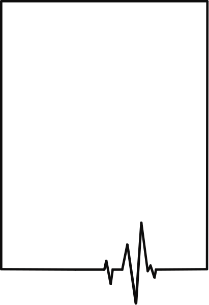 The image shows a black and white representation of an ECG monitor with heartbeat lines on it against a gray background.