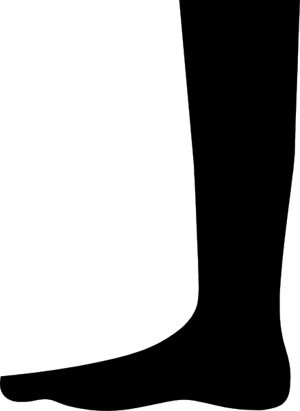 The image shows a black and white striped pattern with no distinguishable content within it.
