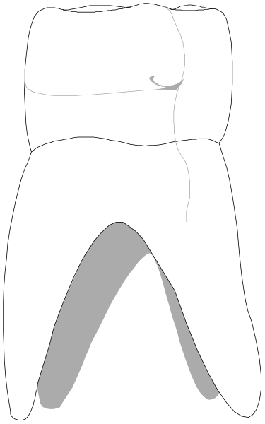 The black and white illustration shows a toothbrush with bristles on top of it next to an open mouth that is missing teeth in front.