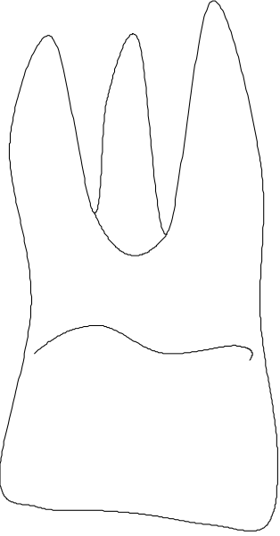 The image shows a white glove with five fingers against a black background.