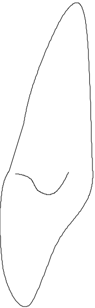 The image shows a close up of two black lines on a gray background with no other discernible content visible due to its small size.