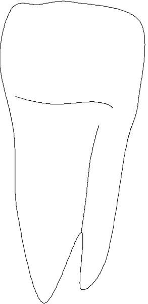 The image shows a white toothbrush with bristles pointing upwards against a gray background.