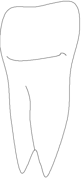 The black and white silhouette of a tooth with an eye peeking out from behind it is shown against a gray background in this small clip-art image.