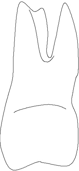 The image shows a black and white pixelated representation of an object that resembles a bunny with long ears sticking out from either side of its head.