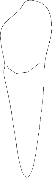 The image shows a gray silhouette of an object with two distinct parts separated by what appears to be a seam or joint in its center.