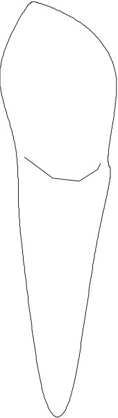 The image shows a closeup of an object with two distinct parts: on its left side is what appears to be a white substance that could possibly resemble ice cream; while on the right side there's another part, which seems like it might have been cut off or obscured by something else.