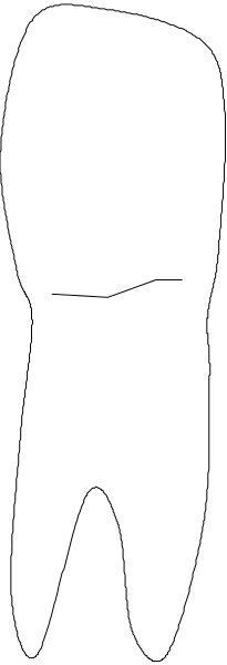 The image shows a black silhouette of an adult human figure standing against a light background with no additional details provided about its surroundings or any other elements in the scene.