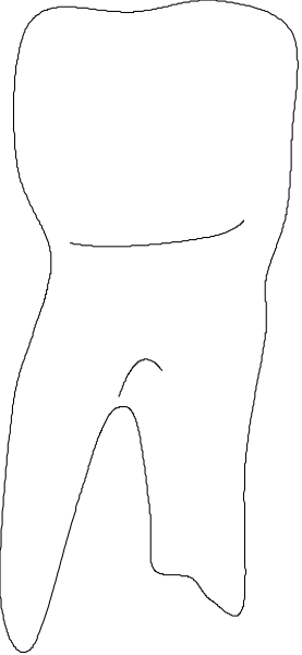 The black and white silhouette of a person walking on their phone with an arm extended outward to balance themselves against gravity's pull in space.