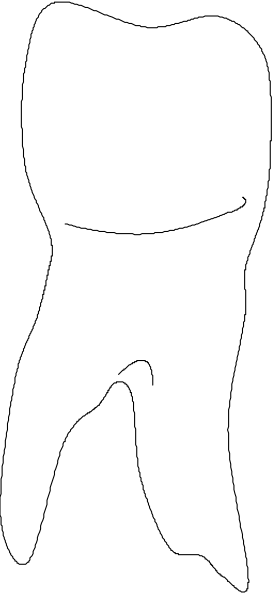The black silhouette of a person walking through an open doorway into another room with light gray walls on either side.