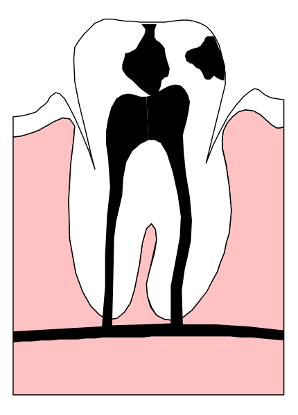The image shows a cartoon of an open mouth with two teeth on either side forming lips around it; inside is pink tissue that resembles gums.