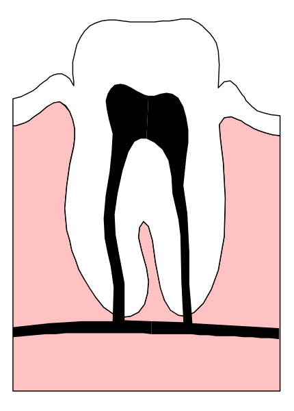 The image shows a cartoon of an open mouth with teeth inside it against a pink background on top right corner; there is also text in black font that reads "DENTIST" at bottom left corner.
