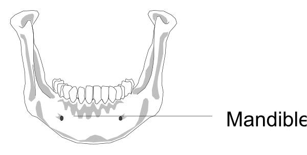 The image shows a black and white illustration of an X-ray with text overlaying it that reads "Ba levi".
