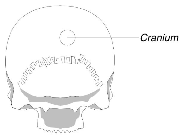 The image shows a skull with annotations indicating that it's missing its cranium (top part of head) due to damage from a bullet hole in frontal bone area.