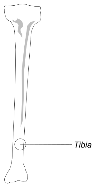 The image shows a diagram of an X-ray with labeled bones including tibia on right side.