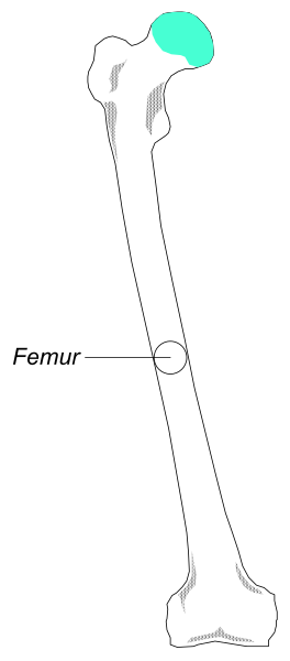 The image shows a diagram of an adult human femur bone with labels indicating its parts such as "Femur" in white text at top right corner against black background.