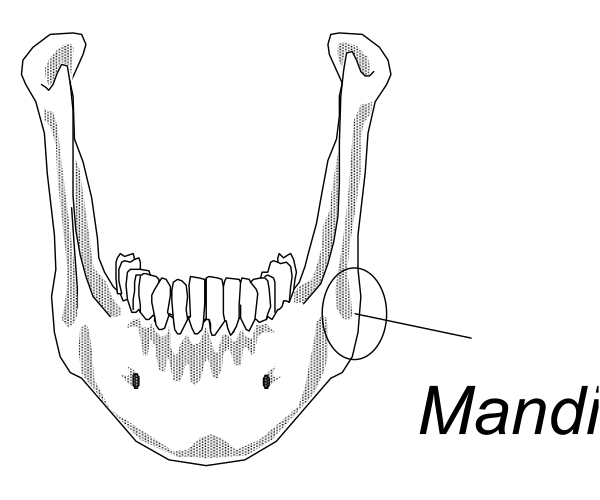 The black and white illustration shows a human skull with annotations pointing to different parts of it: "chin," "man" (likely referring to mandible), and other unidentified labels on various bones, including teeth labeled as canine.