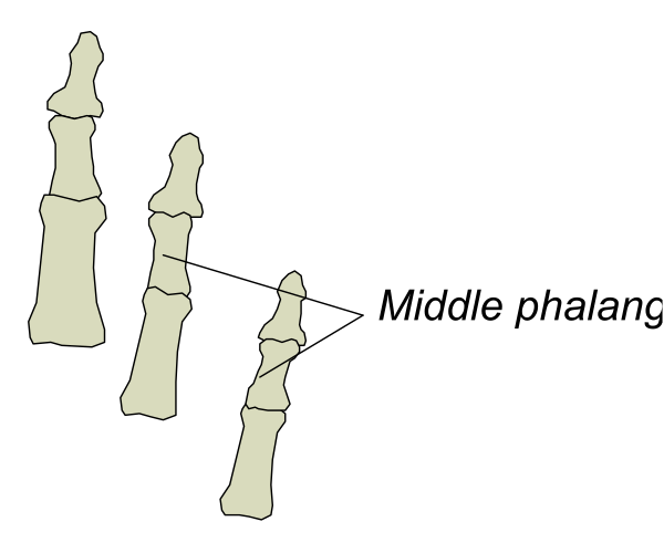 The image shows a diagram of five bones labeled as "middle phalanx" with an arrow pointing to it from another bone that is also labeled but obscured by other elements in the picture.