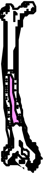 The image shows a closeup of an object with two distinct parts: on top is what appears to be a black substance that could possibly be chocolate syrup; below it lies another layer which seems like pink icing, suggesting this might be part of some sort of dessert or pastry preparation process. There are no people, animals, actions, setting details visible in the image provided. The focus here is on these two layers and their contrasting colors—black atop a lighter shade that could possibly represent white frosting beneath it.
