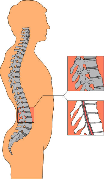 The image shows a human skeleton with anatomical labels for different bones visible on it; to its right is another figure that appears to be in silhouette form against red backgrounds showing various internal organs, and below this pairing of images there's text explaining how the spine relates to these other body parts.