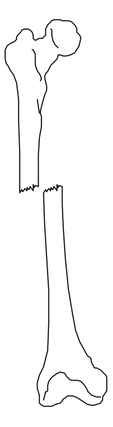 The image shows a skeleton with its bones highlighted against a black background within two white rectangles on either side of it.