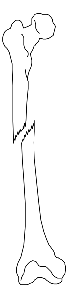 The image shows a black and white illustration of two bones with joints connected by cartilage against a gray background.