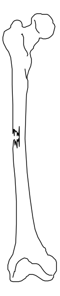 The image shows a skeleton with two bones crossed over each other against a gray background.