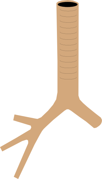 The image shows a simple line drawing of an upside down tree trunk with roots at top against a plain background.
