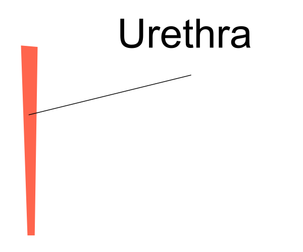 The image shows a simple line drawing of an arrow pointing upwards with text that reads "Uterus" at its tip.