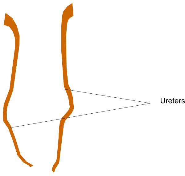The image shows a simple diagram with two labeled parts: "Uterus" on top of another part that is connected to it by an arrow pointing downward from left to right.