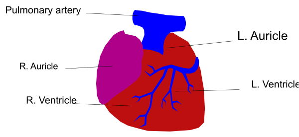 The image shows a diagram of anatomy with labels for different parts: "Pulmonary artery," "R auricle" (right ear), "Ventricle."