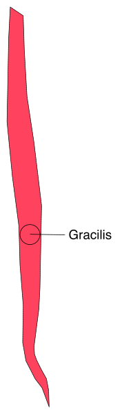 The image shows a red arrow pointing to an area labeled "Gracilis" on what appears to be a medical diagram of human muscles in black against a white background.