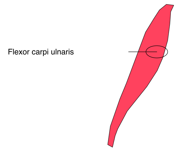 The image shows a red arrow pointing to an area labeled "flexor carpi unaris," which is part of human anatomy indicating where this muscle group can be found in the body.