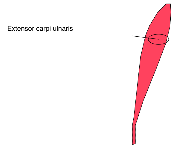 The image shows a simple line drawing of an object with two parts: on the left side is what appears to be a red shape resembling a leaf-like structure; next to it, there's text that reads "EXTENSIOR CARPI ULNARIS."