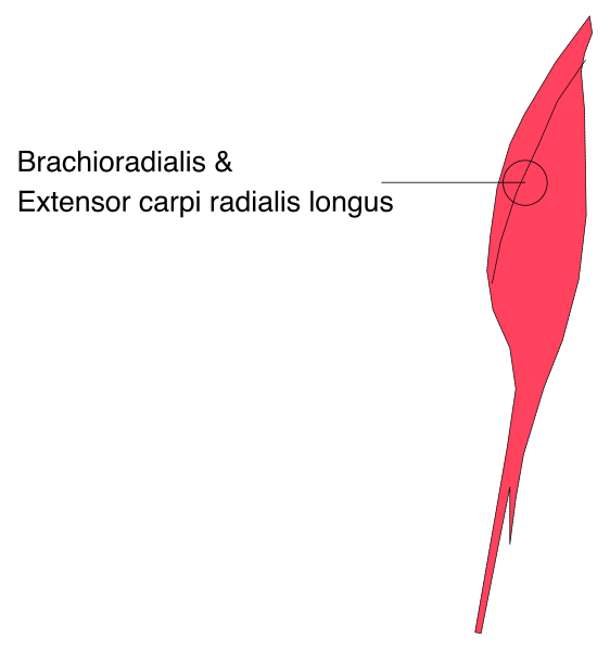The image shows a diagram with labels indicating "brachioadialis" on top of an extended arm bone labeled as "extensor carpi radialis longus."