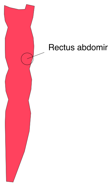 The image shows a red silhouette of an abdominal region with text indicating "Rectus Abdominis" next to it on what appears to be a medical diagram illustrating human body parts in grayscale, possibly for educational purposes.