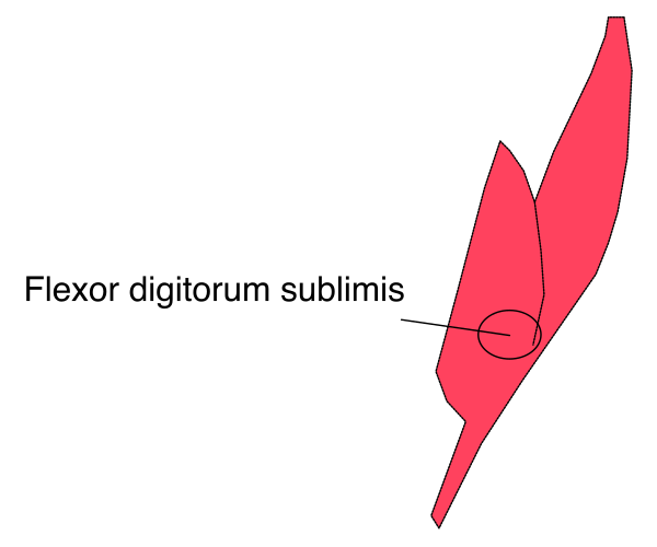 The image shows a diagram with labels pointing to different parts of an object labeled "flexor digitorum sublimis."