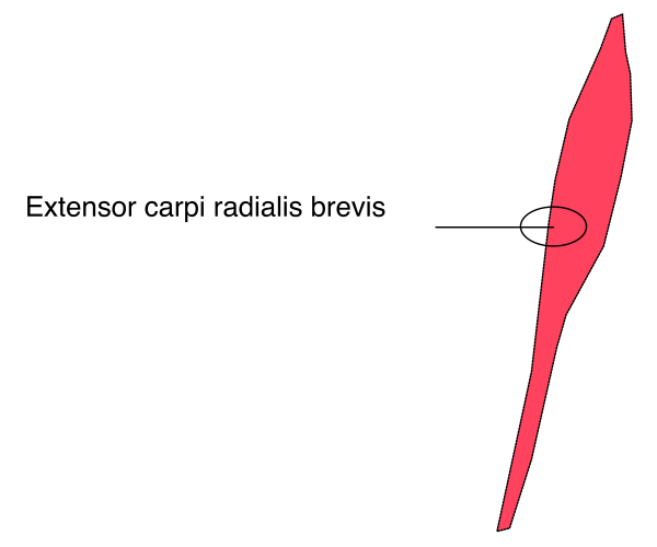 The image shows a diagram with annotations indicating "EXTENSOR CARPI RADIALIS BREVIS" on one side of what appears to be a human hand's carpal tunnel area in red, and another label pointing at something that is not visible within this cropped section labeled as "Carpus radialis brevis." The diagram seems educational or informative.