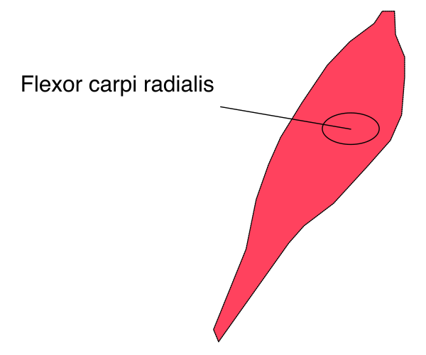 The image shows a simple line drawing of an object with text that reads "flexor carpi radialis."