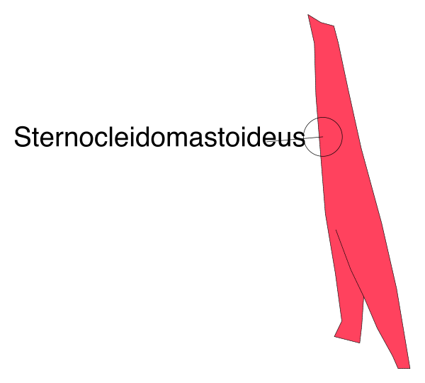 The image shows a red arrow pointing to an object labeled "Sternocleidodomastoides" with text above it that reads "Стеноколеидомастoiдеус."