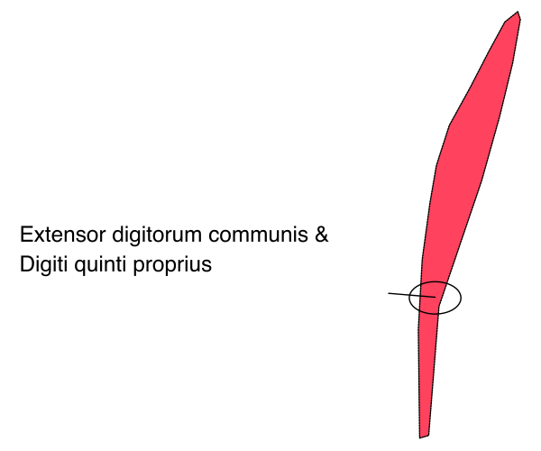 The image shows a red arrow pointing to an extended digit on a digital display with text that reads "EXTENSOR DIGITRUM COMMUNIS & QUANTII PROPRIUS".