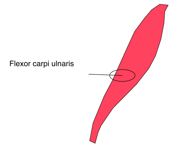 The image shows a simple line drawing of an object with text indicating it's "flexor carpi ulnaris," which is part of human anatomy related to wrist movement.