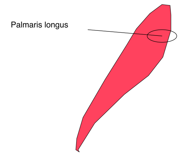 The image shows a simple line drawing of an object with two distinct parts: on the left side is Palmaris Longus labeled in Latin text; to its right is another red shape that appears to be a stylized representation, possibly indicating some sort of measurement or comparison between these objects.