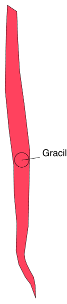 The image shows a red line with two black dots on it against a gray background.