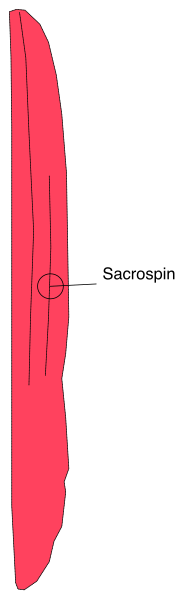 The image shows a red line with an arrow pointing to it from above, labeled "Sacrospin."