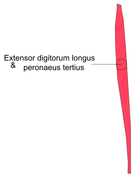 The image shows a graph with two lines labeled "extensor" on top of another line that is marked as "digitonum longitudinis." There's also text indicating an error in measurement at 10 cm, and it mentions "Pelvis," which could be referring to the pelvic bone or region. The image appears educational with a focus on human body parts related to bones of the lower back area. It is not clear if there are any people, animals, actions, or other settings in this clip-art representation as it primarily focuses on anatomical terms