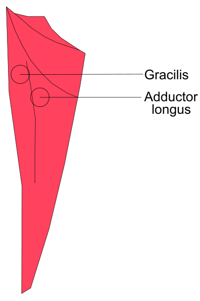 The image shows a red kite with labels indicating its parts: "GRAFICIS," "ADDUCTOR LONGSUS" (gravity-sensitive long sides), and "LONGITUDINES."